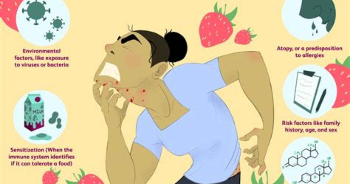 Can You Be Allergic to Some Cheese and Not Others?