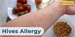 Can You Be Allergic to Strawberry Ice Cream?