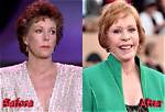 Did Carol Burnett Have Plastic Surgery? Fans Curious About Botox and Facelift