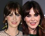Did Zooey Deschanel Get a Plastic Surgery? Facts Behind the Rumors