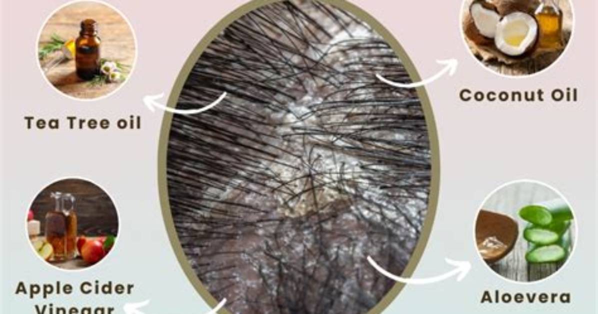 How Do You Get Rid of Fungus on Papaya?