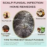 How Do You Get Rid of Fungus on Pecan Trees?