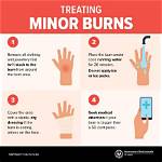 How Do You Treat Palm Disease?