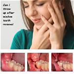 How Soon After Wisdom Teeth Removal Can I Eat Ice Cream?