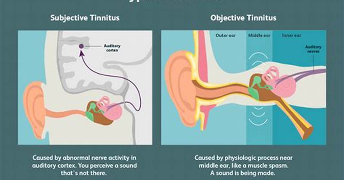 Is Occasional Tinnitus Normal?