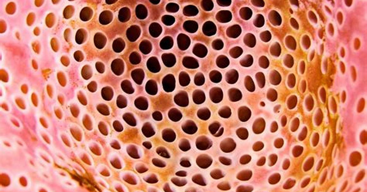 What Are Some Things That Trigger Trypophobia?
