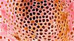 What Are Some Things That Trigger Trypophobia?