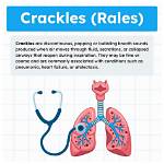 What Do Crackle Sounds Indicate?