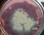What Does King Oyster Mycelium Look Like?