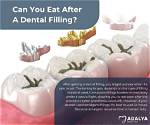 What Not to Eat After Filling?