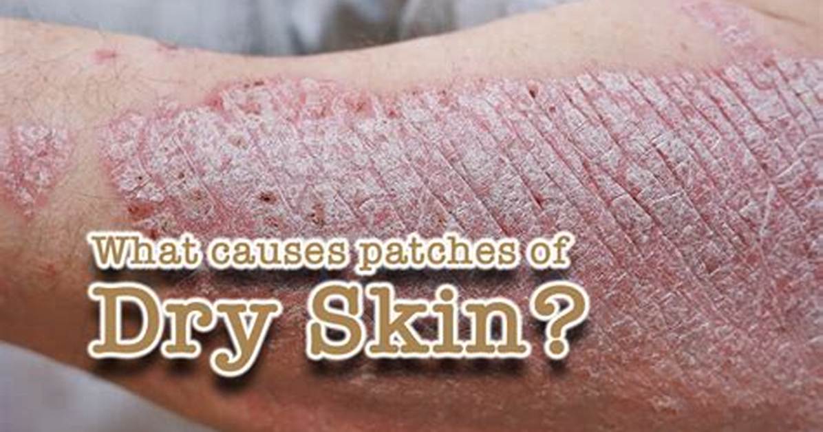 Why Am I Getting Dry Patches on My Grass?