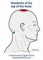 Why Does the Top of My Head Feel Hot?