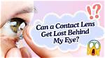 Why Have I Lost Half My Contacts on My iPhone?